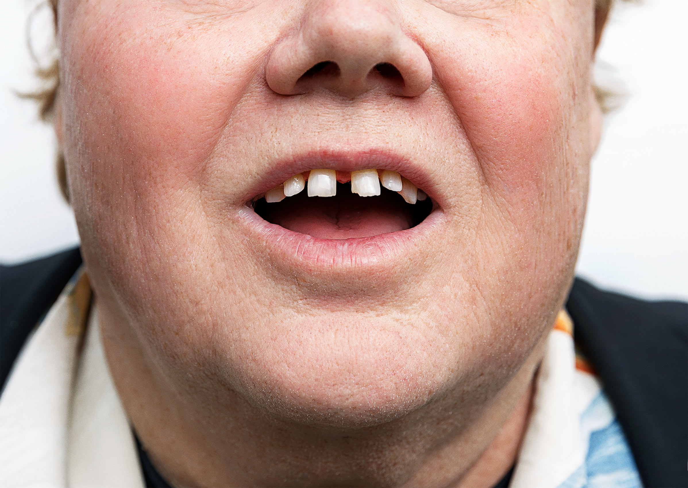 Louie Anderson